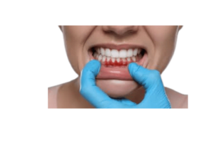 Gum Disease Gone reviews consumer reports (1)