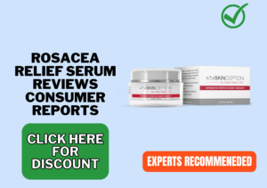 Rosacea Relief Serum reviews consumer reports